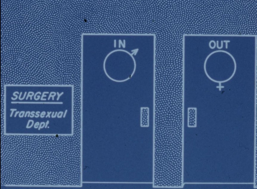 Still from a documentary film produced by the clinicians (but never broadcasted). From the Dayton/Hunt Collection on Transgender Medicine at the University of Washington, Acc. No. 6520-001, University of Washington Special Collections.
